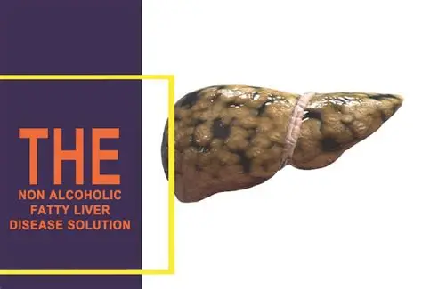 The Non Alcoholic Fatty Liver Disease Solution Review 2026: Reverse Fatty Liver Naturally? 1 The Non Alcoholic Fatty Liver Disease Solution